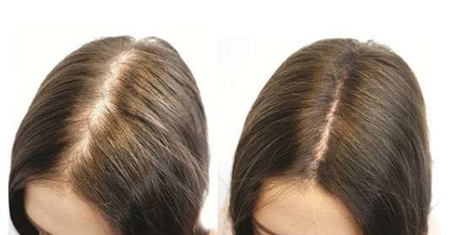 Bài thuốc y học cổ truyền giúp làm mọc tóc sẽ giúp bạn sở hữu mái tóc dày mượt mà