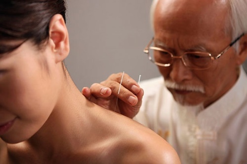 Phương pháp châm cứu chữa bệnh đau mỏi vai gáy