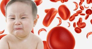 Một số điều cần phải biết về bệnh thiếu máu ở trẻ nhỏ